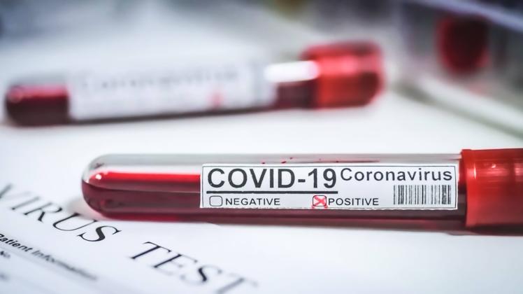 Im Kreis Pinneberg hat es bislang 467 bestätigte Coronavirus-Fälle gegeben.Über Ostern stieg die Zahl nur langsam an, die Testlabore hatten laut Kreis an den Feiertagen aber nicht gearbeitet.
