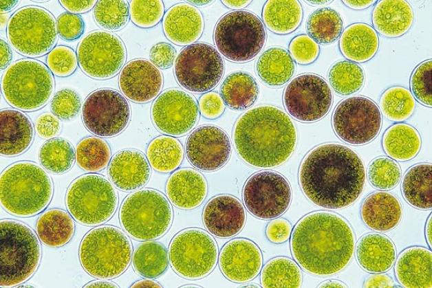 Glitschig, hungrig, nützlich: Alge Haematococcus unter dem Mikroskop. Foto: dpa