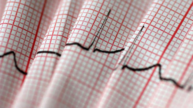 Das Elektrokardiogramm (EKG) zeigt Probleme des Herzens an. Es ist eine der wichtigsten Untersuchungen in der Kardiologie. 