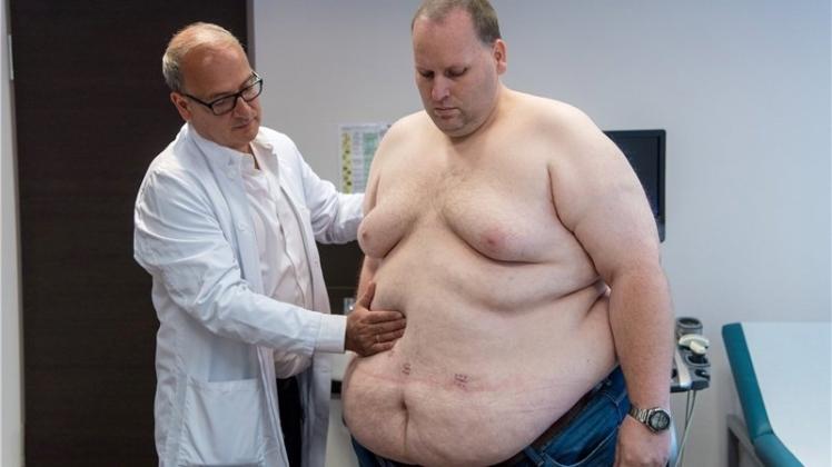 Plamen Staikov (links) untersucht Markus John vier Wochen, nachdem ihm ein „Schlauchmagen“ geformt wurde. Kleine Narben auf dem Bauch des Patienten zeugen von der Operation. 