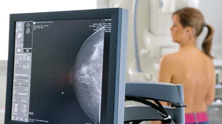 Mit Hilfe der Mammographie kann Brustkrebs bei Frauen früher erkannt werden. 