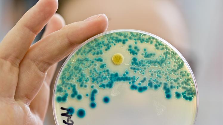 Weltweit nehmen bei Bakterien Unempfindlichkeiten gegen Antibiotika zu. Auf dem Bild zeigt eine Labormitarbeiterin eine Petrischale, in der Bakterien auf Resistenzen getestet werden. 