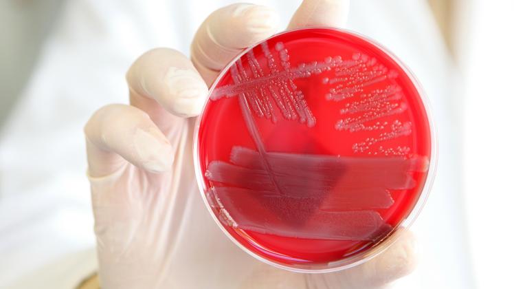 Bakterien sehen rot: Weil immer mehr von ihnen unempfindlich auf Antibiotika reagieren, arbeiten Forscher an Alternativen.