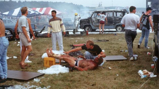 Das Archivbild vom 28. August 1988 zeigt, wie eine durch Brandwunden verletzte Person versorgt wird. Foto: dpa/Zschinsky