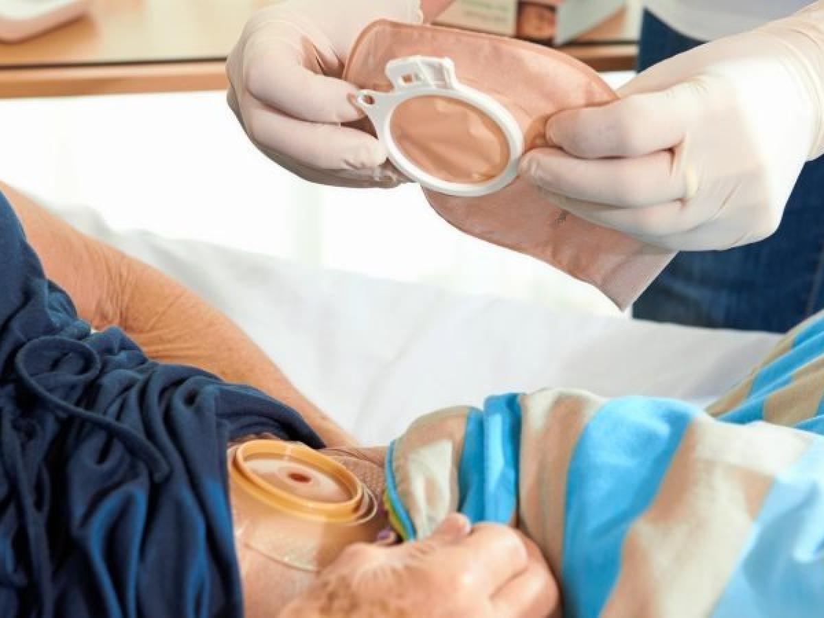 Selbsthilfe fr Stomatrger in der Deutschen