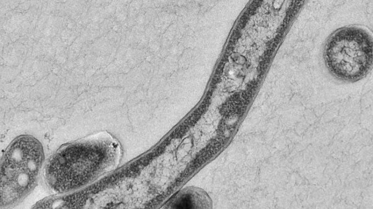 Der Tuberkulose-Erreger Mykobakterium Tuberkulosis, aufgenommen unter dem Elektronenmikroskop. 