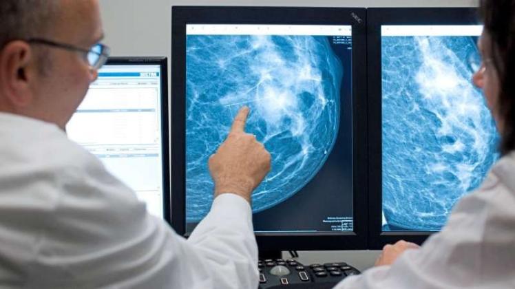 Ein Mediziner stellt eine Auffälligkeit auf einem Mammographie-Scan einer weiblichen Brust fest. Jeder vierte Deutsche wird an Krebs sterben, prognostiziert das Robert-Koch-Institut. 