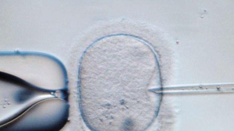 Mikroskopische Aufnahme einer menschlichen Eizelle, die in einem Speziallabor injiziert wird. Eine niederländische Klinik hat möglicherweise durch einen „Verfahrensfehler“ Frauen mit falschem Sperma befruchtet. 
