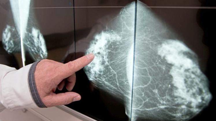 Brustkrebs ist ein Frauen-Killer. 17 000 Tote gibt es allein in Deutschland jedes Jahr. Seit fast zehn Jahren läuft zur besseren Früherkennung das Mammographie-Screening-Programm. Es zeigt Erfolge, sagen viele Experten. Aber geht da noch mehr? 