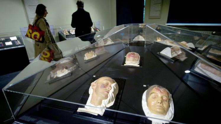 Moulagen, die das Krankheitsbild Syphilis zeigen, liegen im Raum „Moulagen: Krankenheiten in Wachs“ im Medizinhistorischen Museum Hamburg 