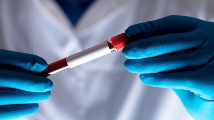 Betrug mit Blutproben wird einem Labor in Nordfriesland vorgeworfen.