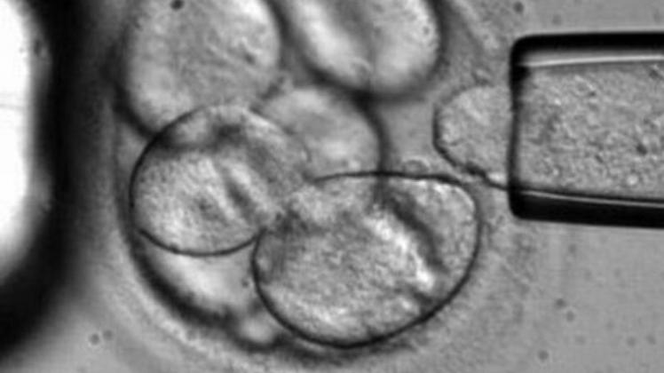 Das Bild zeigt die Entnahme einer einzelnen Zelle aus einem Embryo im Frühstadium.
