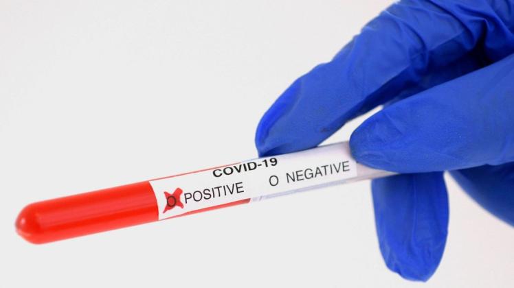 In Neunmünster haben sich 218 Menschen neu mit dem Coronavirus infiziert.