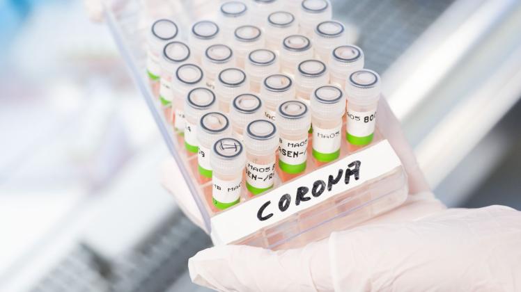 ARCHIV - Eine Assistentin hält ein Gefäß mit aufbereiteten PCR-Tests auf das Coronavirus in der Hand. Foto: Julian Stratenschulte/dpa/Symbolbild ARCHIV - Eine Assistentin hält ein Gefäß mit aufbereiteten PCR-Tests auf das Coronavirus in der Hand. Foto: Julian Stratenschulte/dpa/Symbolbild