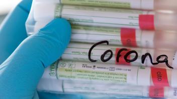 ARCHIV - Proben für Corona-Tests werden für die weitere Untersuchung vorbereitet. Foto: Hendrik Schmidt/dpa-Zentralbild/Symbolbild