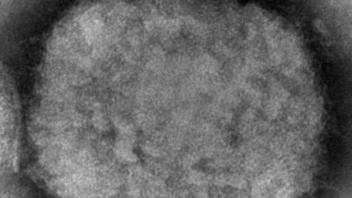 HANDOUT - Die elektronenmikroskopische Aufnahme zeigt ein Affenpockenvirus. Foto: Cynthia S. Goldsmith/CDC via AP/dpa - ACHTUNG: Nur zur redaktionellen Verwendung und nur mit vollständiger Nennung des vorstehenden Credits