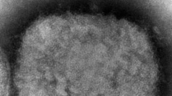 HANDOUT - Diese elektronenmikroskopische Aufnahme zeigt ein Affenpockenvirus. Foto: Cynthia S. Goldsmith/CDC via AP/dpa - ACHTUNG: Nur zur redaktionellen Verwendung und nur mit vollständiger Nennung des vorstehenden Credits