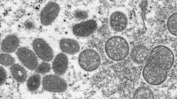 HANDOUT - So sehen die Viren der Affenpocken aus, wenn man sie unter dem Mikroskop anschaut. Foto: Cynthia S. Goldsmith/Russell Regner/CDC/AP/dpa - ACHTUNG: Nur zur redaktionellen Verwendung und nur mit vollständiger Nennung des vorstehenden Credits