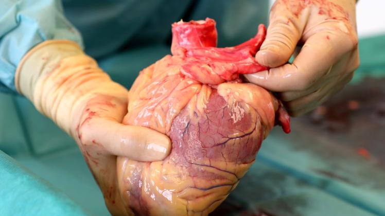 Chirurgen fordern Information über Organspende bereits an Schule