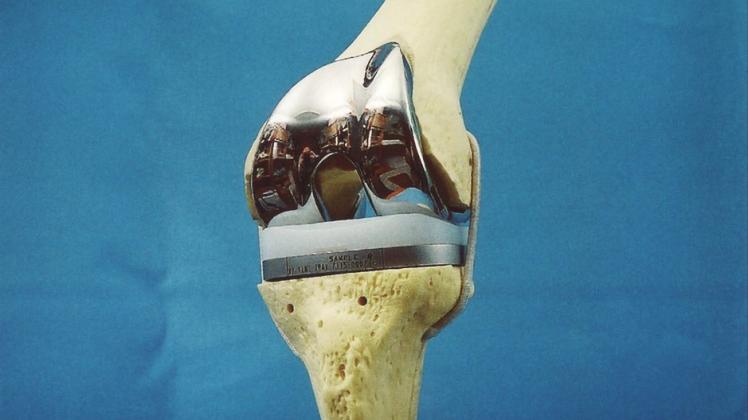 Bestandteile des Vortrags werden neben der Anatomie des Kniegelenkes die verschiedenen Schmerzursachen wie zum Beispiel Meniskusschäden, Knorpelschäden und Arthrose sein.