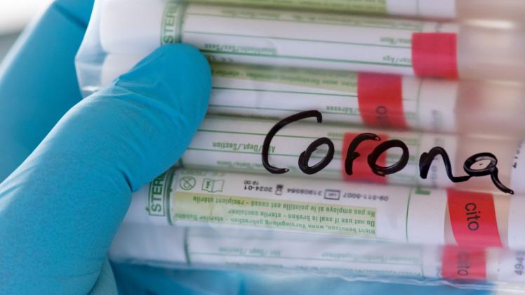 ARCHIV - Proben für Corona-Tests werden im Diagnosticum-Labor in Plauen für die weitere Untersuchung vorbereitet. Foto: Hendrik Schmidt/dpa-Zentralbild/Symbolbild