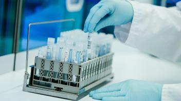 ARCHIV - Ein Mitarbeiter bereitet in einem Heidelberger Coronatest-Labor PCR-Teströhrchen vor. Foto: Uwe Anspach/dpa