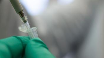 ARCHIV - Ein Forscher bereitet im Landesgesundheitsamt Baden-Württemberg einen PCR-Test für die Analyse auf Mutationen des Coronavirus vor. Foto: Sebastian Gollnow/dpa