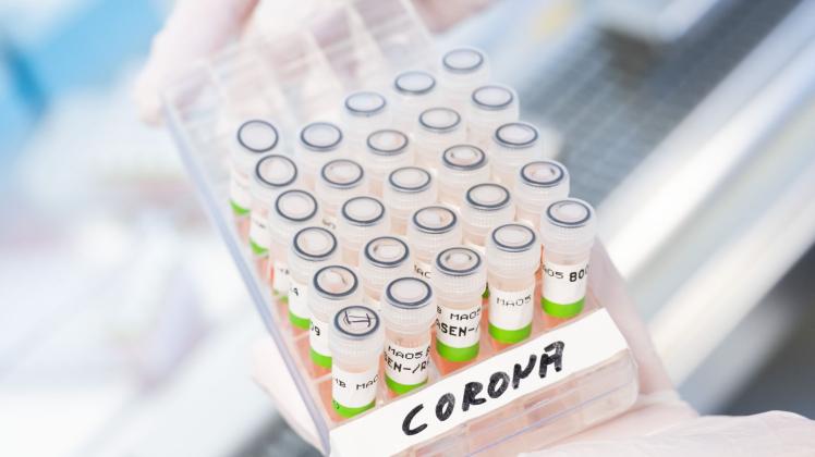 ARCHIV - Eine biologisch-technische Assistentin hält ein Gefäß mit aufbereiteten PCR-Tests auf das Coronavirus in der Hand. Foto: Julian Stratenschulte/dpa/Symbolbild