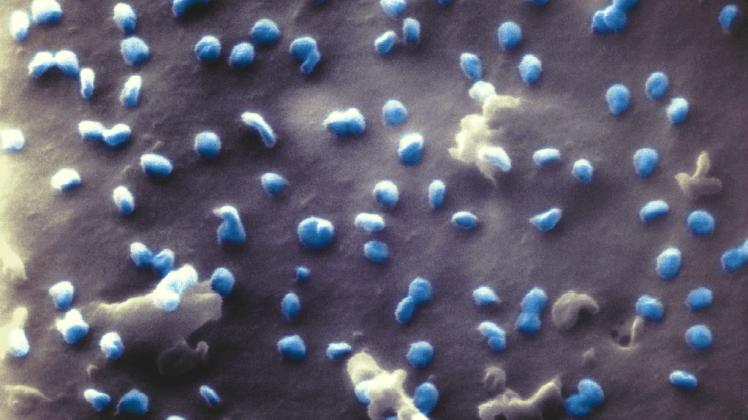 Nano-Aufnahmen der Uni Bielefeld zeigen Coronaviren an Wirtszelle