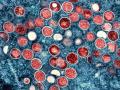 Affenpocken, rasterelektronenmikroskopische Aufnahme des Affenpockenvirus  July 26, 2022, Fort Detrick, MD, United Stat