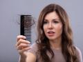 Worried Woman Suffering From Hairloss model released Symbolfoto PUBLICATIONxINxGERxSUIxAUTxONLY C