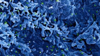 ARCHIV - Eine kolorierte rasterelektronenmikroskopische Aufnahme des Affenpockenvirus (grün) auf der Oberfläche von infizierten VERO E6-Zellen (blau). Foto: Niaid/Niaid/Planet Pix via ZUMA Press Wire/dpa