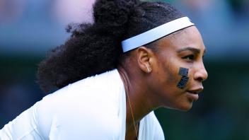 Mandatory Credit: Photo by Javier Garcia/Shutterstock (13002021jz) Serena Williams sporting a plaster on her cheek and