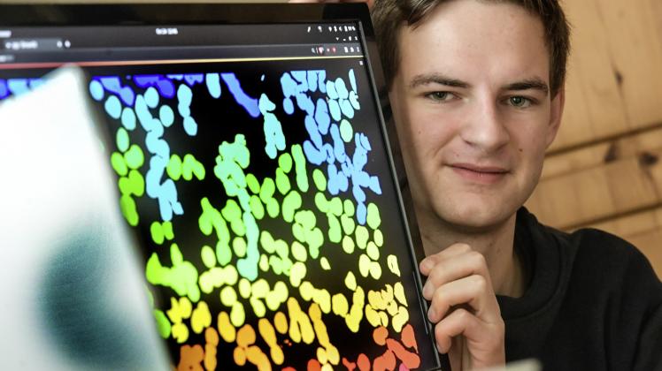 Was für andere aussieht wie ein Bildschirmschoner, ist für David Rutkevich die Darstellung von Blutzellen, die sein Algorithmus erkennen kann. 