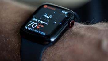 Puls und EKG: Kann die Smartwatch Herzprobleme erkennen?
