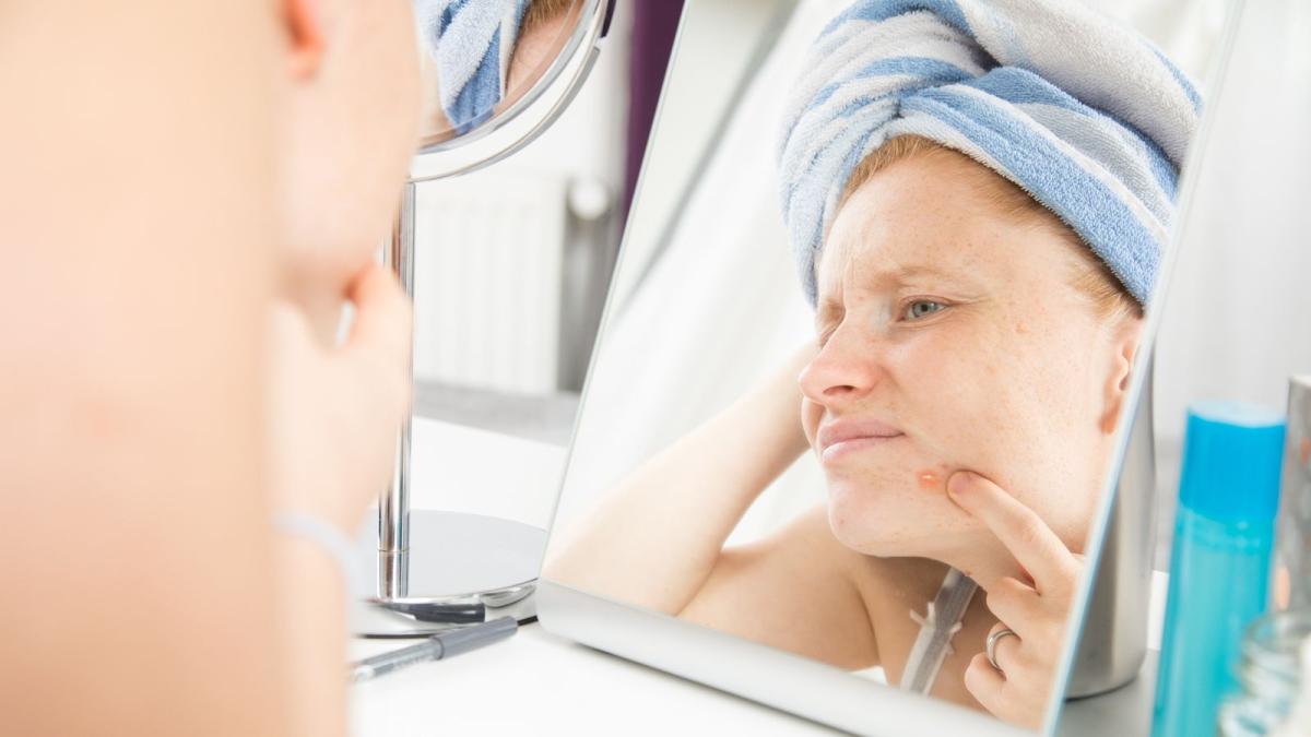 Skin Picking: Was tun, wenn Pickel ausdrücken zur Sucht wird
