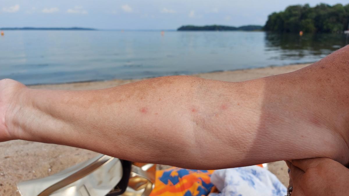 Zerkarien im Schweriner See Wo beim Baden Vorsicht geboten ist NNN