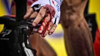 Illustration picture shows the injured hand of French David Gaudu of Groupama FDJ after the second s