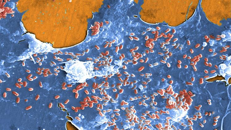 Meb water This digitally colorized scanning electron microscopic (SEM) image of an untreated water specimen extracted fr