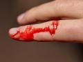 Cut finger bleeding, Finger cut and bleeding skin index finger on hand, in need of a plaster, 10.11.