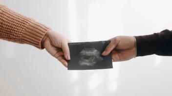 Ultraschallbild einer Schwangeren Frau 