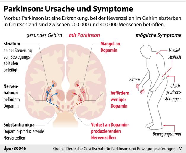 Hat Man Bei Parkinson Schmerzen www.dk-online.de