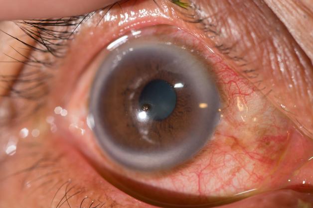 Ring Um Die Augen Medizinisch