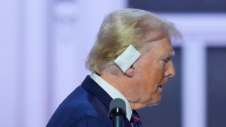 Wie Steht Es Um Die Schusswunde An Trumps Ohr Arzt Nennt Details wie-steht-es-um-die-schusswunde-an-trumps-ohr-arzt-nennt-details