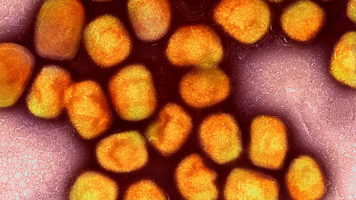 RKI-best-tigt-Erster-Nachweis-von-neuer-Mpox-Variante-in-Deutschland