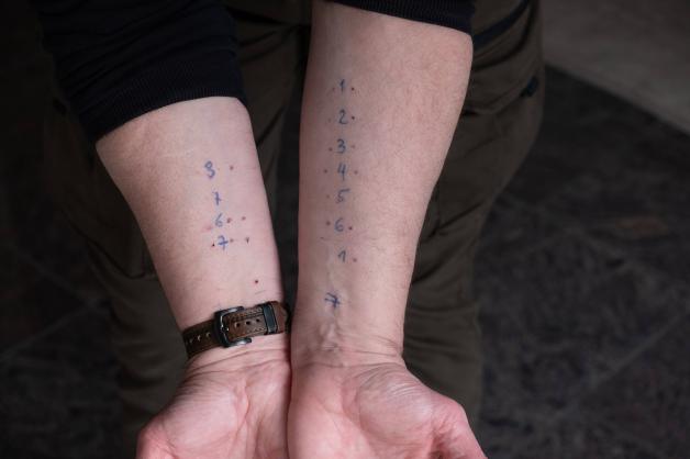 Der Prick-Test ist Formsitz, MIT allergisch Festtellen Können. Der Prick-Test ist Formsitz, MIT allergisch Festtellen Können.
