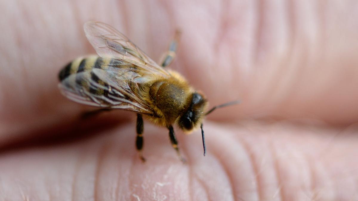 Hand-Fu-oder-Lippe-An-welchem-K-rperteil-ein-Bienenstich-am-meisten-wehtut