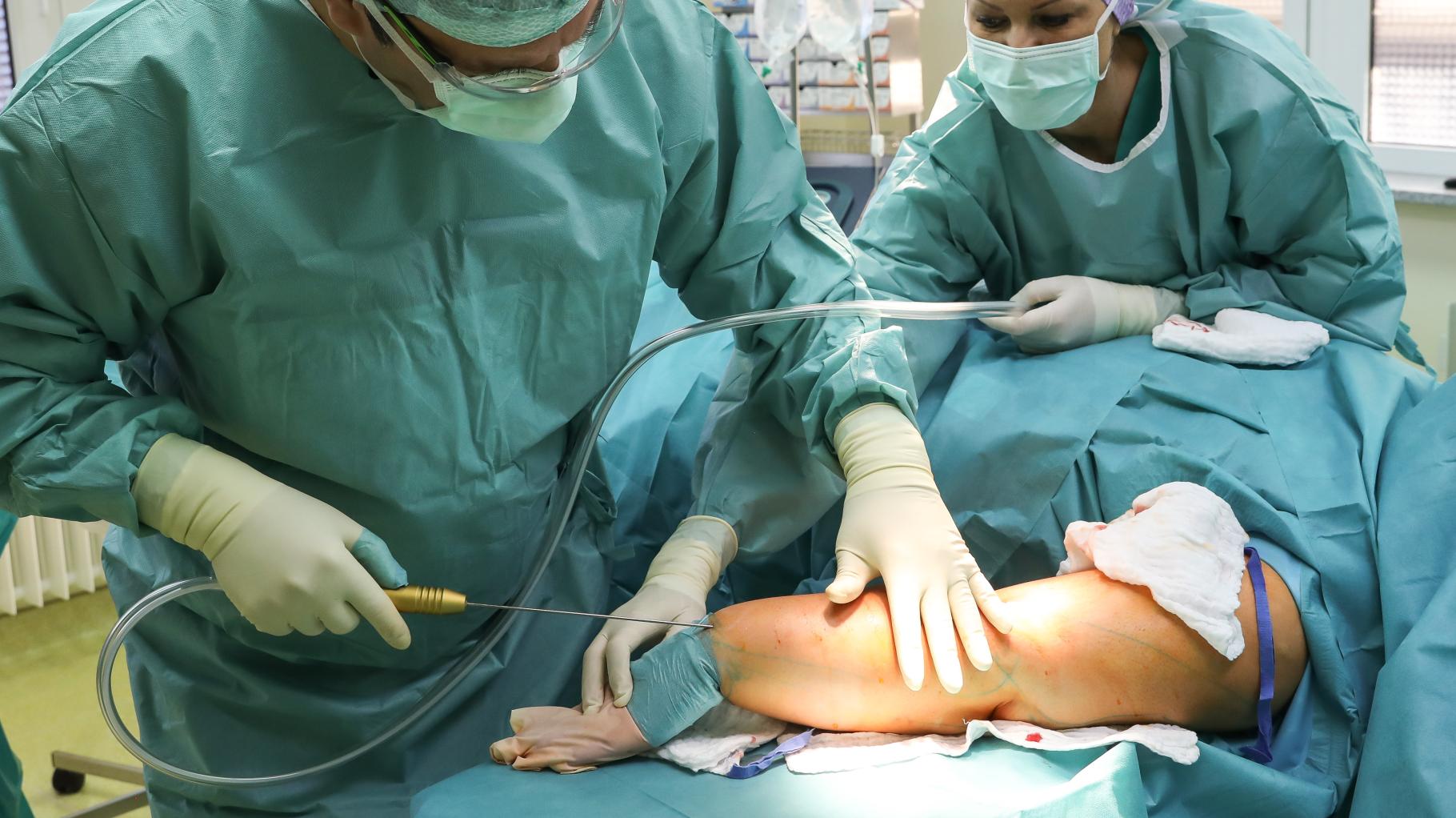 Zavarovalnice krijejo stroške operacij lipoedema, kar olajšuje življenje prizadetim ženskam