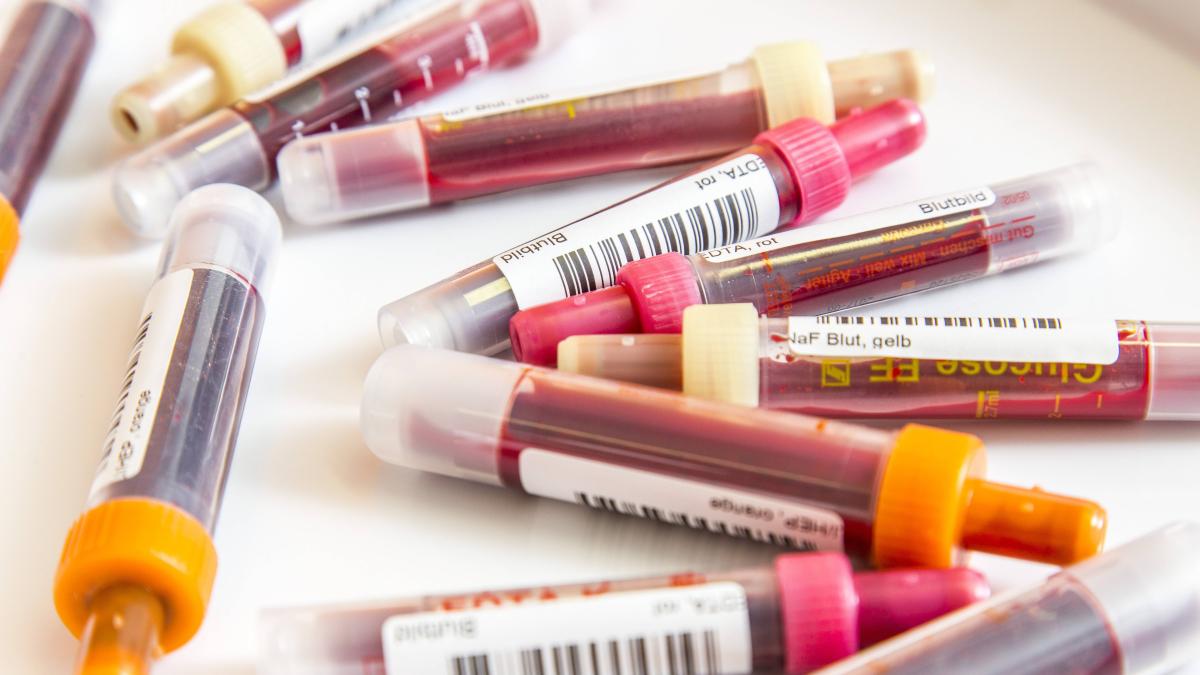 Diabetes-Leber-Nieren-welche-Blutwerte-Sie-vom-Arzt-checken-lassen-sollten