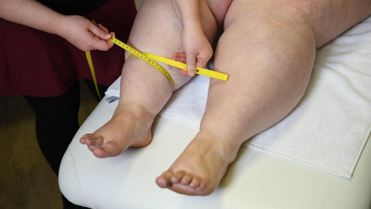 Lymphatic and lipedema: 5 tips for what you can do for your body